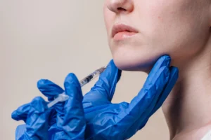 Masseter Botox in London