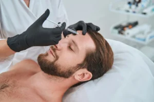 Mens Treatments for Forhead Lines in London