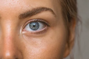 What to Expect Before During and After Blepharoplasty in London